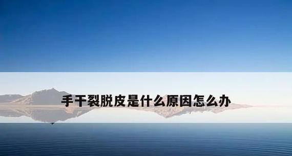 如何正确清洗皇朝油烟机（清洗皇朝油烟机的步骤和注意事项）
